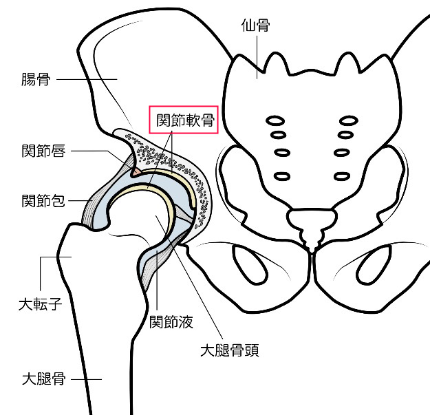 変形性股関節症のイメージ画像