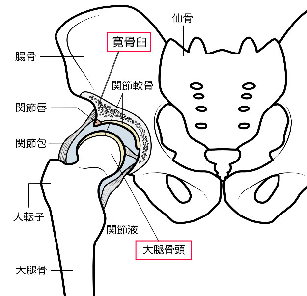 股関節インピンジメント症候群のイメージ画像