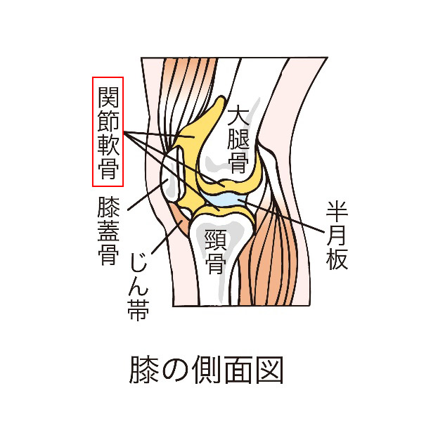 変形性膝関節症のイメージ画像