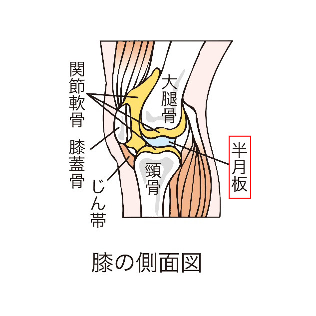 半月板損傷のイメージ画像