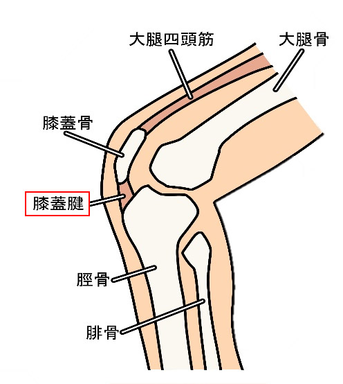 ジャンパー膝（膝蓋腱炎）のイメージ画像