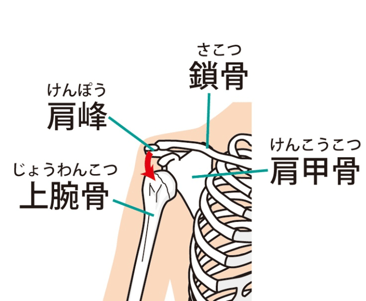 肩関節脱臼（かたかんせつだっきゅう）のイメージ画像